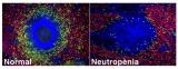 Es descobreix l’existència de neutròfils a la melsa